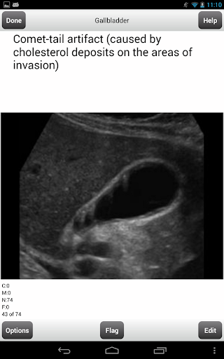 【免費教育App】ARDMS Ultrasound Flashcards Lt-APP點子