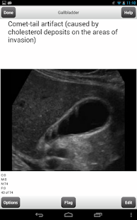 How to download ARDMS Ultrasound Flashcards Lt 2.46 apk for laptop