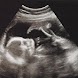 Baby Kick Counter