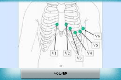 Electrocardiograma PRO poster 9