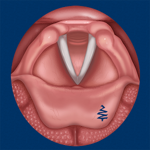 Vocal Folds ID logo