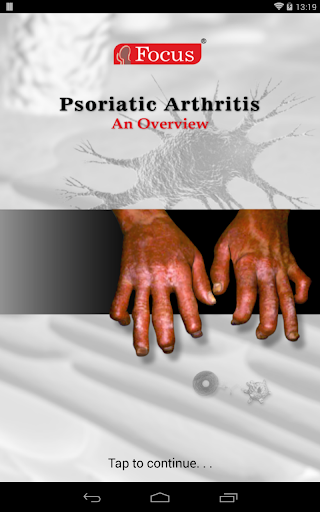 Psoriatic Arthritis