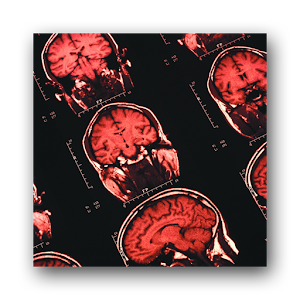 癌症防治必读 1.1