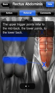 Muscle Trigger Point Anatomy - screenshot thumbnail