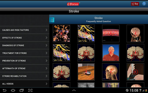 【免費醫療App】FAQs in Stroke-APP點子