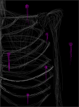 Bones?