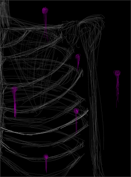 Bones?