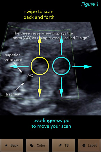 You-Scan ultrasound training