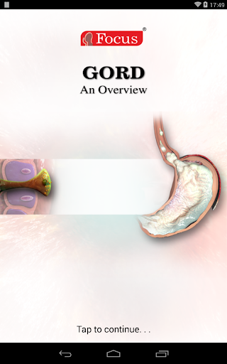 GORD GERD - An Overview