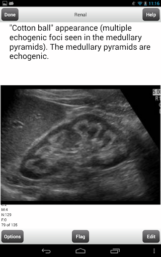 【免費教育App】ARDMS Abdomen Ultrasound Cards-APP點子