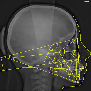 Cephalometric Analysis.apk 1.2.2
