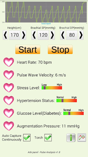 Pulse Analysis