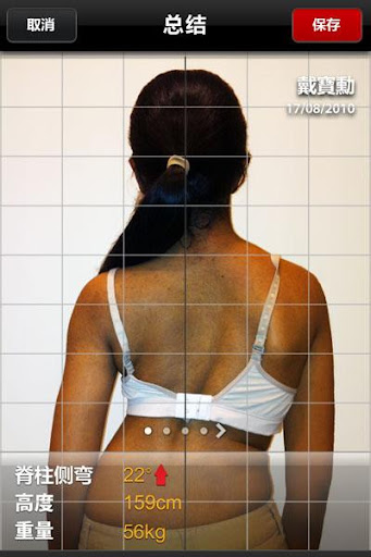 免費下載醫療APP|脊柱側彎跟踪 (ScolioTrack) app開箱文|APP開箱王