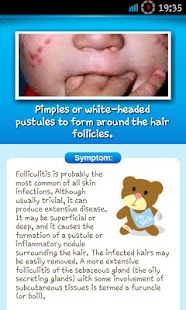 How to mod Baby Skin Problem & Guide Lite lastet apk for bluestacks
