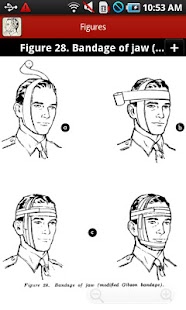 Bandaging and Splinting Screenshots 5