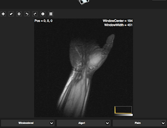Simple Dicom Viewer poster 4