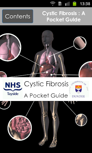 Cystic Fibrosis:A Pocket Guide