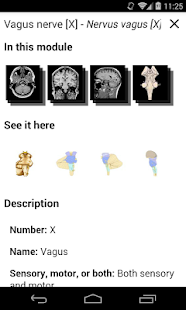 IMAIOS e-Anatomy