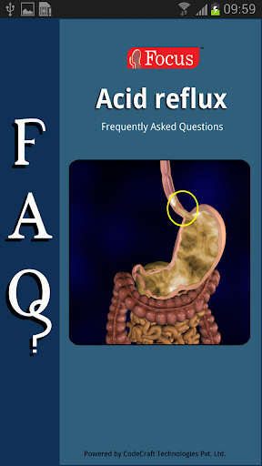 FAQs in Acid Reflux