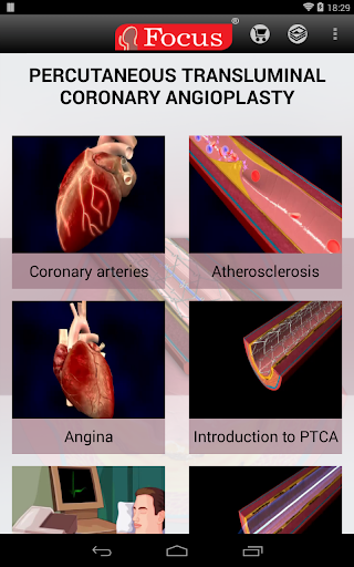 【免費醫療App】Coronary Angioplasty - PTCA-APP點子