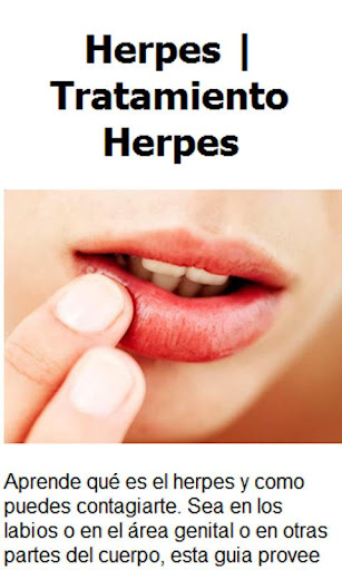 Herpes Tratamiento