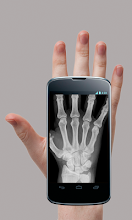 X-Ray Scanner Prank APK Download for Android