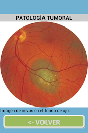 ophthalmology poster 17