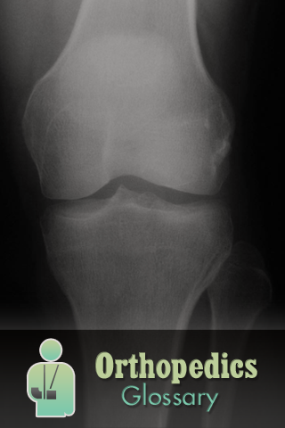 Orthopedics Glossary