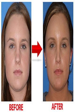 How To Lose Face Fat