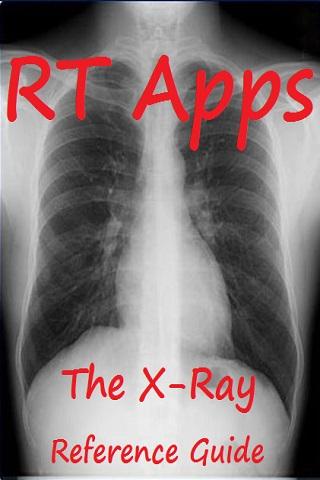 X-Ray Positions