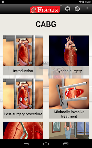 免費下載醫療APP|Coronary Artery Bypass Graft app開箱文|APP開箱王