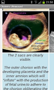 How to install Obstetric Ultrasound 1.0 unlimited apk for pc