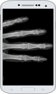 X-Ray Scanner Screenshots 1