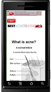 Lastest Best Acne Treatment APK