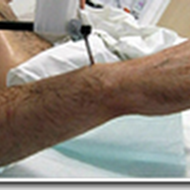 First Double-Arm Transplant Is a Success