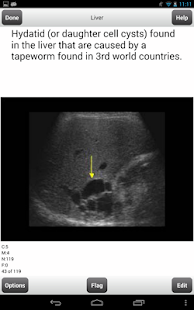 How to get ARRT Ultrasound Cards Lite lastet apk for bluestacks