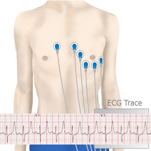 Basic ECG Interpretation 2