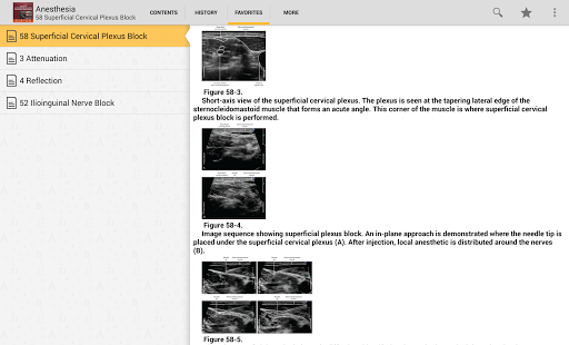 Atlas Ultrasound Anesthesia TR Screenshots 15