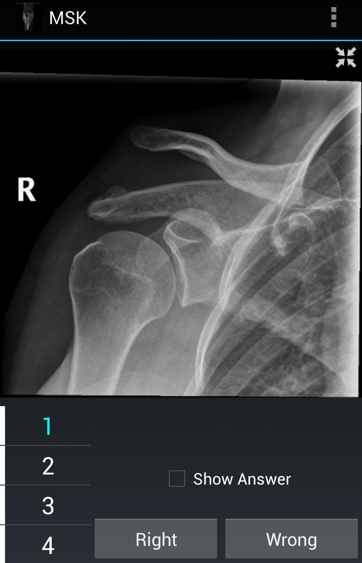 Radiology Flashcards: MSK Screen 2