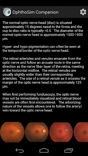 【免費醫療App】OphthoSim Companion Demo-APP點子