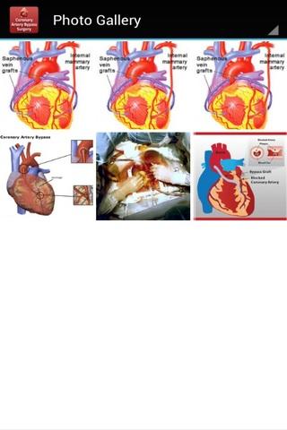 免費下載醫療APP|Coronary Artery Bypass - CIMS app開箱文|APP開箱王