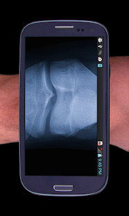 Xray- Prank Screenshots 5