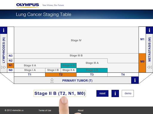 【免費醫療App】Lung Cancer Staging Table-APP點子