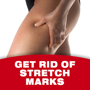 Get Rid Of Stretch Marks.apk 1.11.19.69