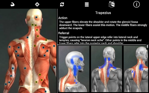 Muscle Trigger Point Anatomy - screenshot thumbnail