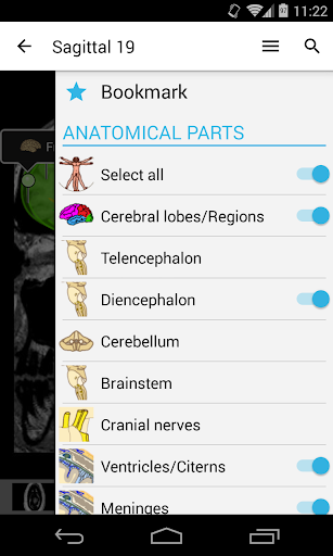 【免費醫療App】IMAIOS e-Anatomy-APP點子