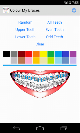 Colour My Braces