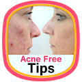 Acne Free Tips Apk