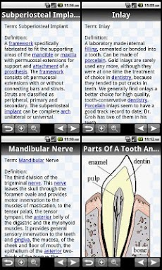 Glossary of Dentistryのおすすめ画像2