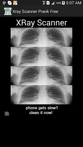 X射線掃描儀惡作劇
